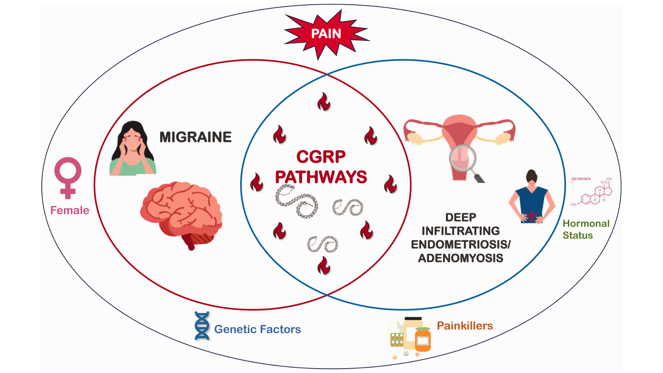 The Link Between Endometriosis and Migraine