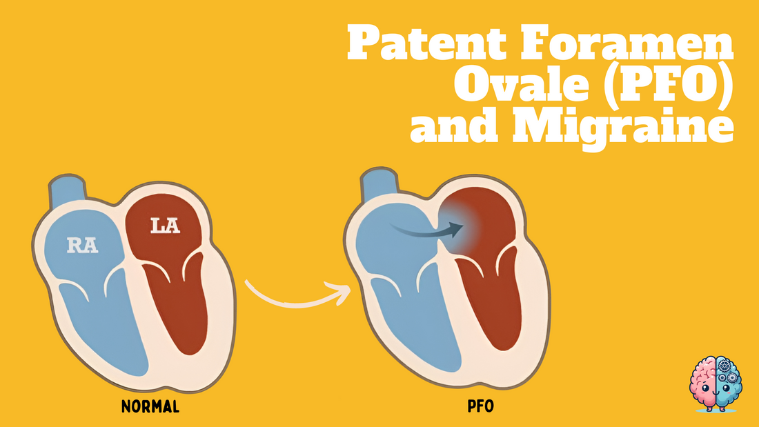 Patent Foramen Ovale and Migraine